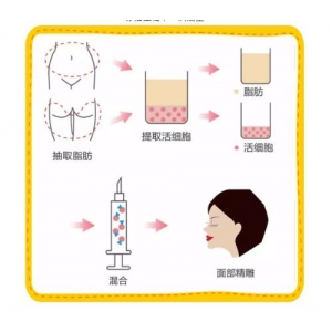 汇美医疗整形美容医院医生团队信息介绍！面部填充手术前后对比