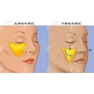呼和浩特京美整容好吗？做脂肪填充效果如何？附案例和价格表！