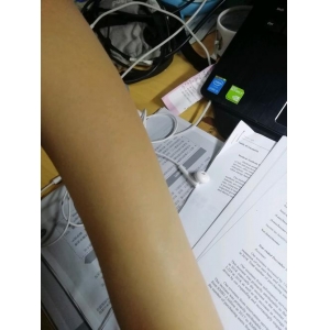 安阳哪家医院可以做冰点脱毛你知道吗？技术怎么样？口碑又如何