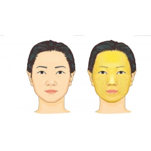 武汉做自体脂肪丰卧蚕哪些医院靠谱？精选6家技术过硬的医疗机构