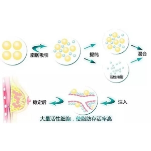 东莞东城禾美医疗美容正规吗?医院简介_价格费用及医生团队解析