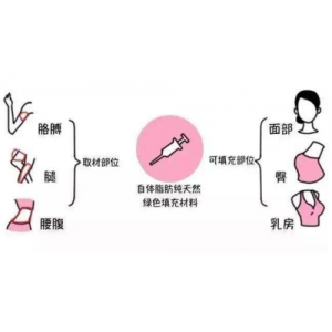自体脂肪丰鼻基底安全吗？宁波慈溪REAL悦尔医学美容医院专业解答