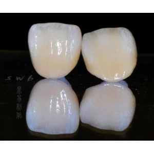 烤瓷牙和全瓷牙区别，价格怎么样？