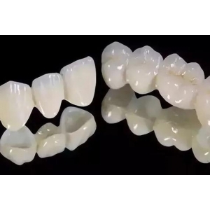 烤瓷和水晶哪个好？都有哪些区别呢？