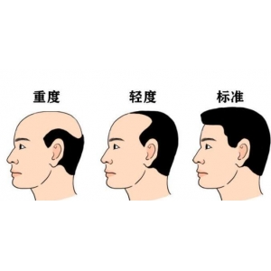 福州美人尖种植哪家医院靠谱？格莱美、海峡等5家机构深度解析