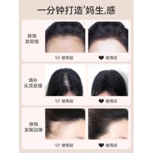 重庆当代整形外科医院植发效果怎么样？真实评价与专业分析