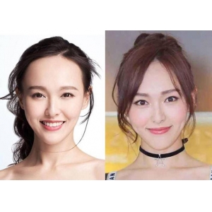杭州哪家医院做发际线种植效果好？5家专业植发机构真实测评