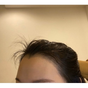 北京博士园是正规医院吗？王朝刚博士领衔的毛发移植专科机构，18年技术积淀铸就京牌实力！
