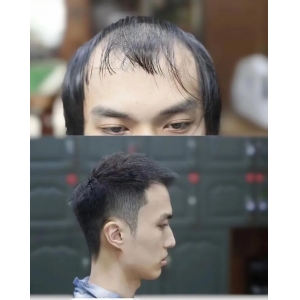 广州改善眉毛残缺好的医院有哪些？口碑排名前五分享，实力派