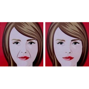 无锡施尔美医疗美容医院石雪冰医生怎么样？专业玻尿酸注射技术解析-真实案例分享-患者口碑评价