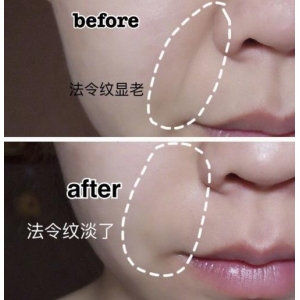 贵阳美莱医疗美容医院概况_真实案例解析_整形收费指南
