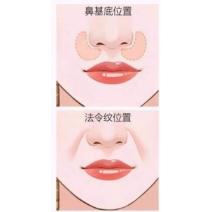厦门欧菲医疗美容医院水光除皱技术怎么样？资深医师团队带你了解抗衰秘诀