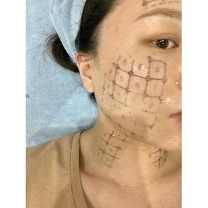 昆明轮廓塑形哪家医院靠谱？博美、吴氏嘉美、奥拉克技术解析