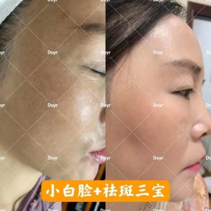 大连美天医疗美容医院祛斑技术怎么样？专业医生团队打造无瑕肌肤