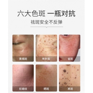 济南艺星整形美容医院祛斑技术怎么样？听听专业医生怎么说