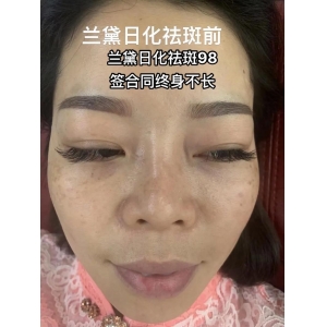 上海鹏爱医疗美容祛斑效果怎么样？专业医生团队帮你告别色斑困扰