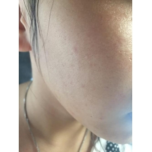 北京彤美医美是正规医院吗？东城区老牌整形机构，专注眼鼻整形与修复，实力口碑双认证！
