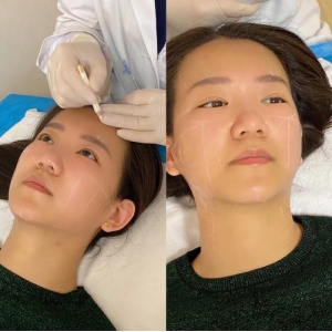 潍坊天宏医疗美容医院隆胸修复怎么样？专业医生团队与真实案例解析