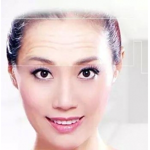 昆明艺星医疗美容医院紧致轮廓医生排行榜！实力派专家都在这
