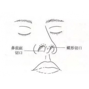 西京整形医院樊星口碑好不好？附详细案例分析及价格表