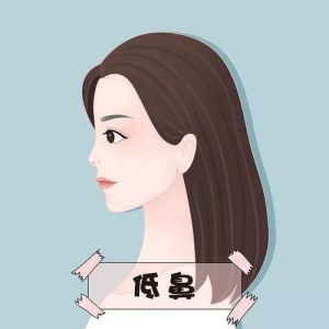 贵阳华美紫馨整形美容医院怎么样？玻尿酸注射价格及专家医生团队介绍
