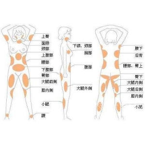 珠海陆达美容外科医院去副乳怎么样？专业医生团队，隆胸技术精湛