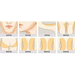 苏州维多利亚整形医院2025价格全览:亲民价格与卓越技术的完美结合