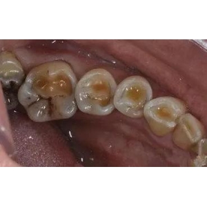 成都天使之翼整形美容医院牙齿矫正怎么样？专业医师团队打造自信笑容