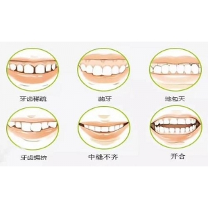 牙齿保持器哪个好？选对适合自己的保持器很重要