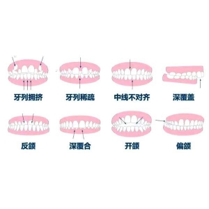 洗牙跟拔牙哪个痛？拔牙这些事项需注意