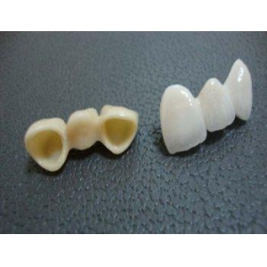 颌垫矫正牙齿费用多少？了解不同类型颌垫的价格表一览及长期佩戴的成本