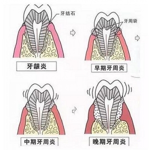 淮南市韩国奥齿泰种植体套餐医院排行榜前十名口碑好-淮南市韩国奥齿泰种植体套餐口腔医院