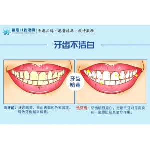 西安交通大学第一附属医院牙齿矫正价格贵吗？资深医生团队解析