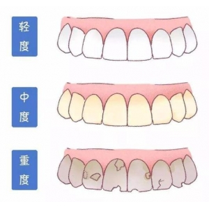 呼和浩特牙齿矫正医院哪家靠谱？这份真实价格表帮你避开选择困难