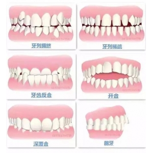 隐形牙套和钢丝牙套哪个效果更好？_区别_适用人群_价格表