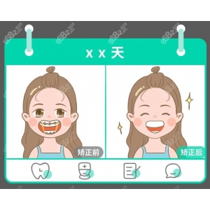 合肥牙齿矫正哪家医院好？靓美口腔-思德口腔-适美口腔-佳德众兴口腔-大众口腔等专业机构对比评测