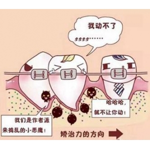 大牙疼看哪个科？大牙疼的原因跟解决方法你要知道