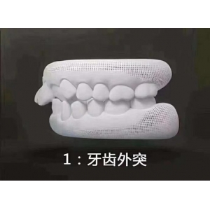 菏泽美尔口腔医生技术怎么样？牡丹区专业牙科矫牙和种植案例真实分享！