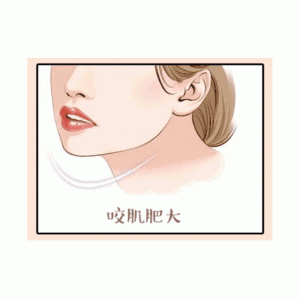 三亚福音妇产医院去颊脂垫技术怎么样？专业医生解析+真实案例分享