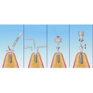 河源恒信口腔医院的技术技术怎么样？曝光匠心技艺，解读技术水平
