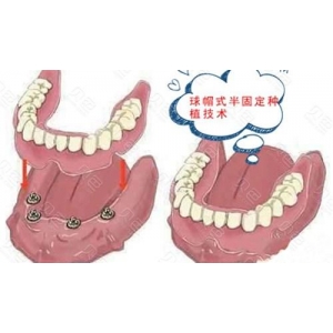 杭州薇琳口腔医院用户技术怎么样？值得信赖的医院选择！