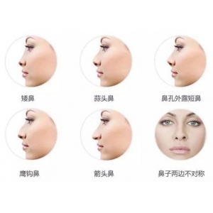 成都正规整形医院线雕隆鼻哪家强？美极、天使之翼、素美等实力盘点