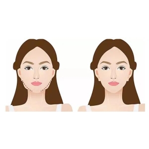 深圳博美医疗美容线雕隆鼻技术怎么样？资深医生团队+价格全解析