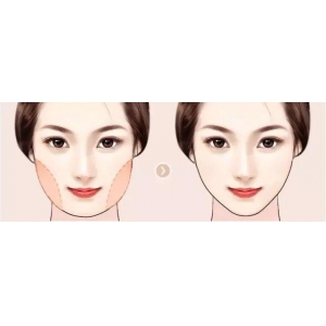 苏州美莱美容医院自体脂肪填充怎么样？四位专家技术特色与真实案例分享