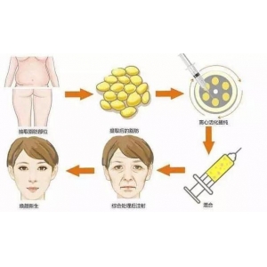 南昌自体脂肪填充哪家靠谱？二附院、佳美、莱美等6家医院对比