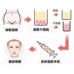 大连自体脂肪填充哪家医院好？这5家医美机构口碑与技术双在线