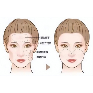 合肥自体脂肪填充哪家医院靠谱？6家实力医美机构深度解析