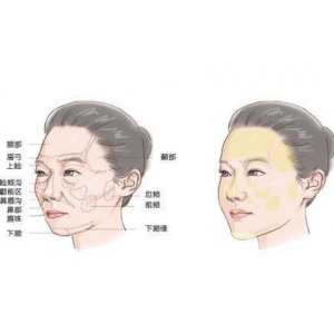 大连沙医生整形美容口腔专科医院做自体脂肪丰卧蚕靠谱吗？真实效果与价格解析