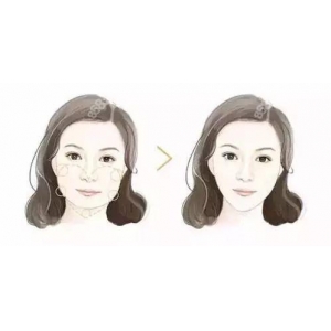 赣州做自体脂肪丰鼻基底哪家医院靠谱？韩美、亚韩、东方薇琳真实对比
