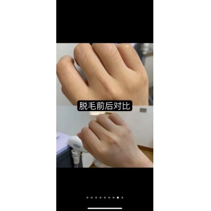 北京美丽嘉医疗美容正规吗？解析其JCI认证资质、韩国背景医生团队与真实用户口碑！